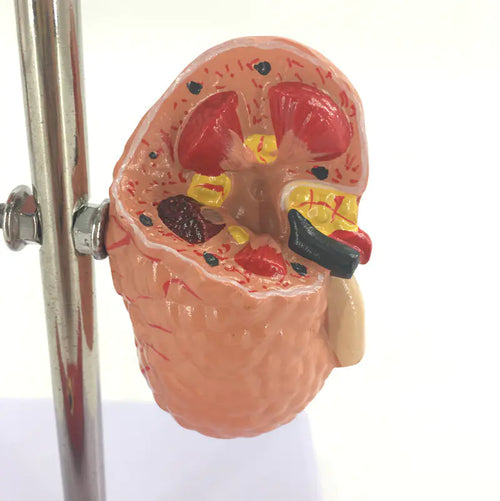 5-Part Hypertension Model for Brain, Heart, and Organs
