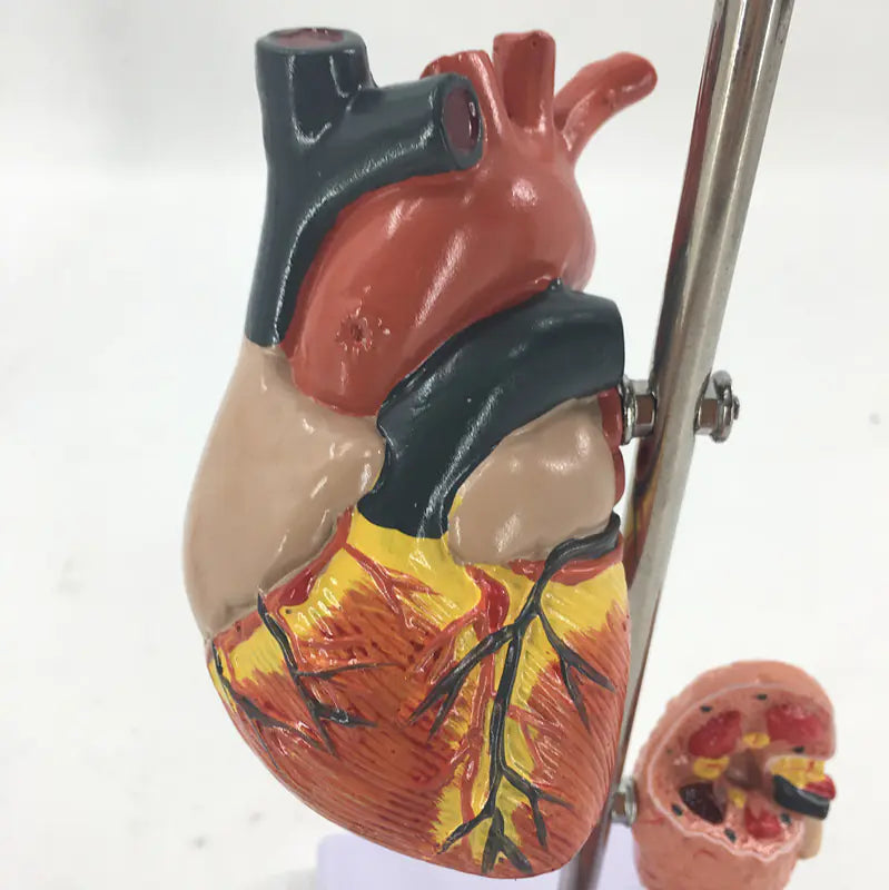 5-Part Hypertension Model for Brain, Heart, and Organs