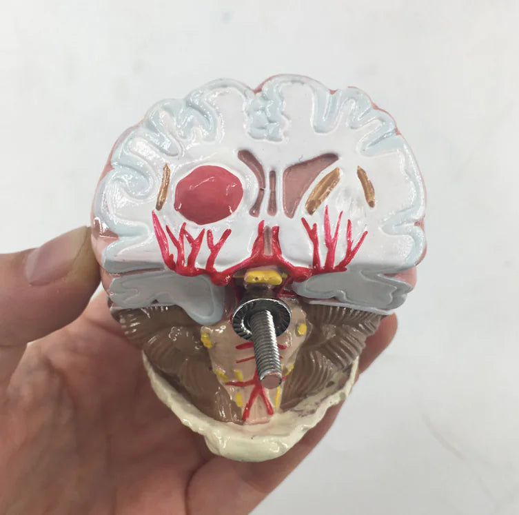 5-Part Hypertension Model for Brain, Heart, and Organs