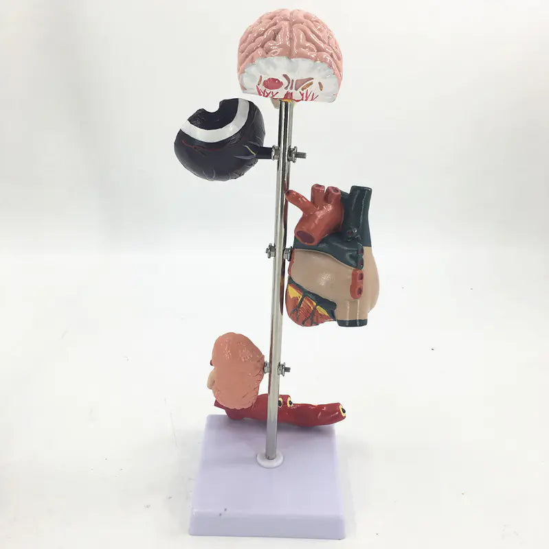 5-Part Hypertension Model for Brain, Heart, and Organs